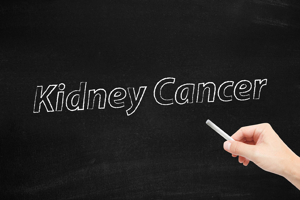 The Symptoms and Stages of Kidney Cancer