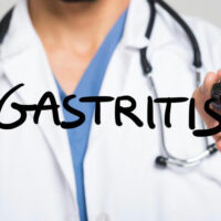 5 foods to avoid when gastritis strikes