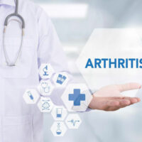 A brief overview of arthritis