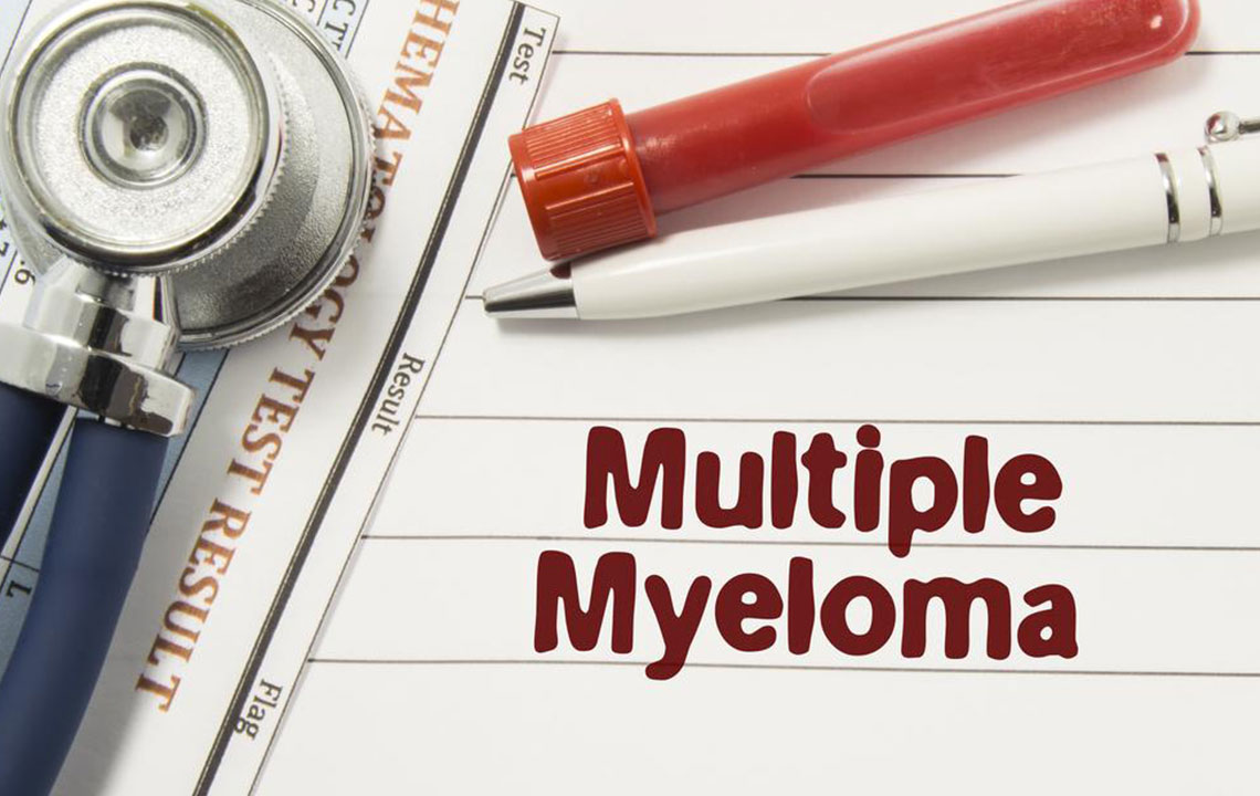 Dealing with multiple myeloma &#8211; Things you should know about