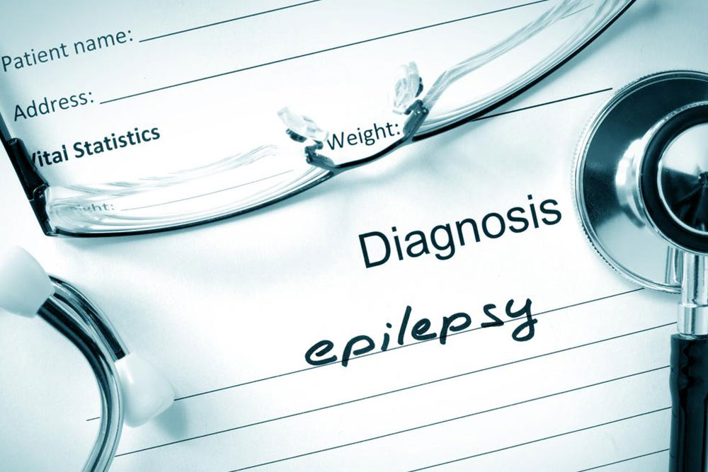 Everything you need to know about epilepsy