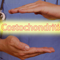 Symptoms, Causes, and Management of Costochondritis