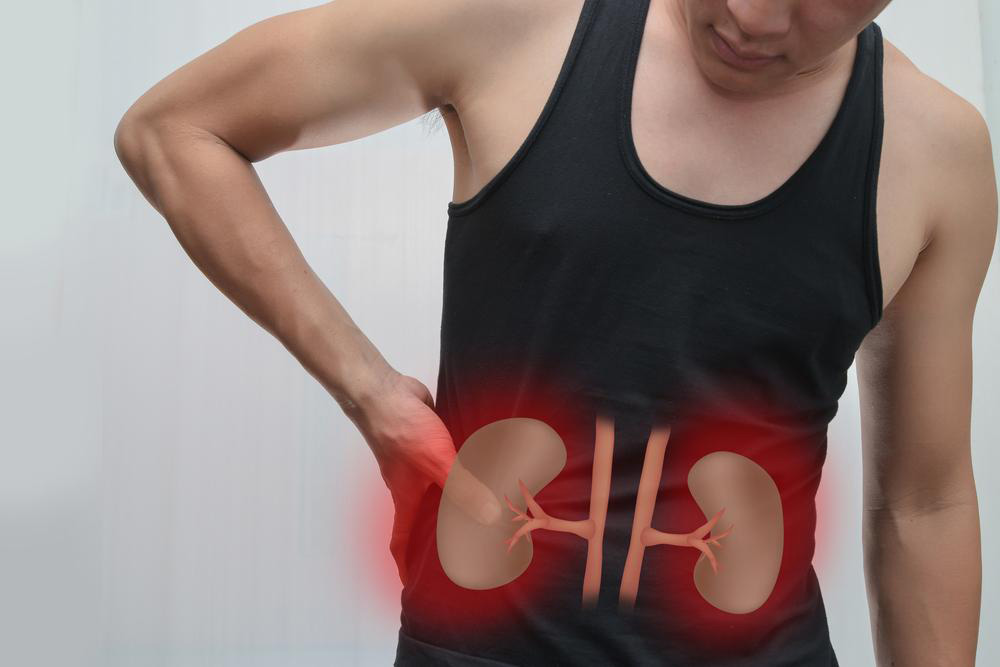 Treatment options for various causes of kidney pain