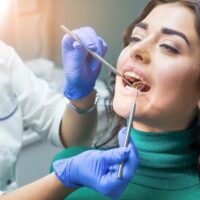 A Guide To Buying Dental Insurance